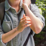 虫刺されで腫れがひどくなる原因とは?正しい対処法と治療法